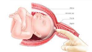 Close-up of healthcare provider's hand during membrane sweep