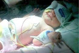 An image of a premature baby in an incubator. The baby is being carefully monitored with medical equipment, such as heart rate and oxygen monitors, in a neonatal intensive care unit (NICU) setting. The environment is calm and equipped with specialized care tools for premature infants.