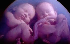 An ultrasound image showing twin fetuses inside the womb, positioned side by side in a clear black-and-white view. The outlines of the fetuses are visible, with their heads, spines, and limbs distinct, surrounded by the amniotic sac within the uterus.
