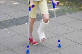 Person with leg cast walking with crutches: Casts care