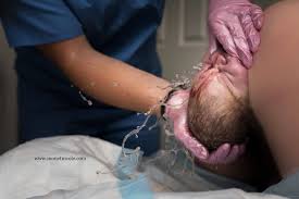 Healthcare provider guiding baby's head during vaginal delivery