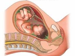 An image showing a cross-section of a fetus inside the womb, highlighting the developing baby surrounded by amniotic fluid. The fetus is depicted in a realistic, detailed view with visible features like limbs and facial contours, and the surrounding uterine wall is shown in a soft, anatomical illustration.