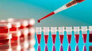 A blood sample being placed into a test tube for analysis in a laboratory setting.