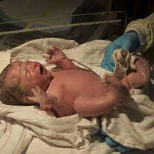 Physical assessment of a newborn baby by healthcare professional