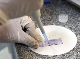 Lab tech examining Pap smear slide through a microscope: cervical cancer screening