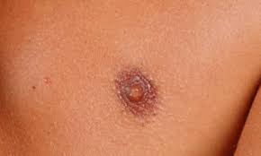 breast health: Close-up image of a human nipple, showing its natural texture and pigmentation.