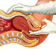 Cross-section of a bimanual pelvic exam