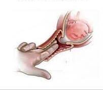 Cross-section of a vaginal exam