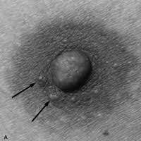 Montgomery's tubercles are small, raised bumps located around the nipples