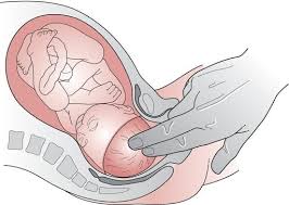 Performing a membrane sweep