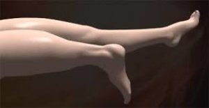  Surgical procedure for limb salvage