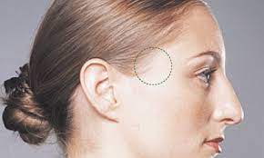 pressure to the temple region, outer corner of the eyebrow, for headaches, relaxation and tension relief