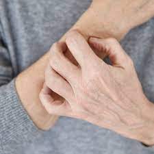 Person scratching their arm due to skin irritation