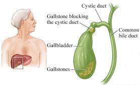 Gall bladder anatomy: Understanding its role and potential issues
