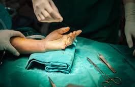 Person undergoing a surgery in their arm