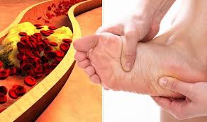 Person experiencing plantar pain with blood vessel in background: symptom of High cholesterol