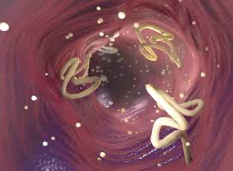 Worms adhered to the intestine