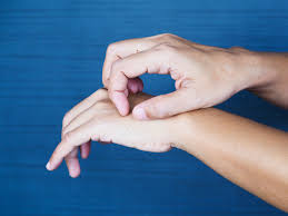 Person scratching hand - Itchy skin, a common symptom of potential ringworm infection