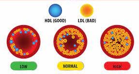  Cholesterol Comparison - Differentiating LDL and HDL Lipoproteins