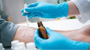 Healthcare professional wearing blue gloves, administering a test dose of medication to a patient, with attention to the injection process.